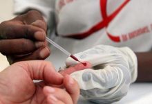 فيروس داء فقدان المناعة المكتسبة